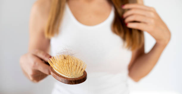 istock young woman have hair loss problem 1352138385