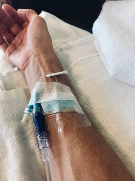 istock Female arm with chemotherapy line injected into arm. 1352148491