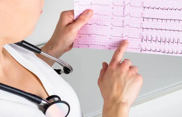 A female doctor analyzing an electrocardiogram, doing an ECG interpretation / EKG interpretation