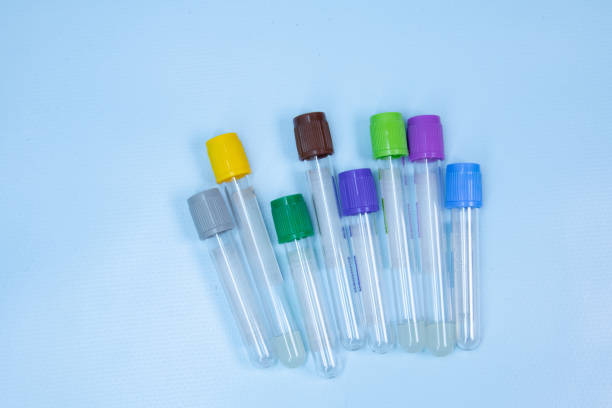 istock Vacuum tubes for collection and blood samples on blue background with sodium citrate EDTA heparin fluoride anticoagulant for laboratory on blue background 1352260882