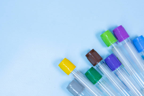 istock Vacuum tubes for collection and blood samples on blue background with sodium citrate EDTA heparin fluoride anticoagulant for laboratory on blue background 1352260902