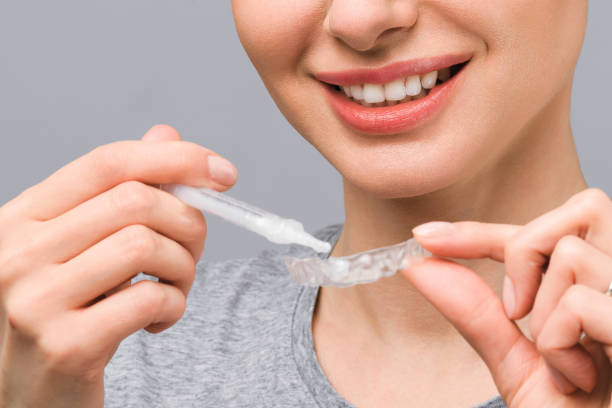 A young woman does a home teeth whitening procedure. Whitening tray with gel A young woman does a home teeth whitening procedure. Whitening tray with gel. tooth whitening photos stock pictures, royalty-free photos & images