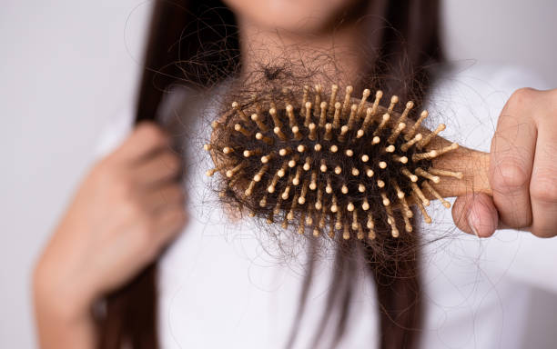 Healthy and hair loss concept. Woman holding a comb with her damaged long loss hair. Healthy and hair loss concept. Woman holding a comb with her damaged long loss hair. woman hairline stock pictures, royalty-free photos & images