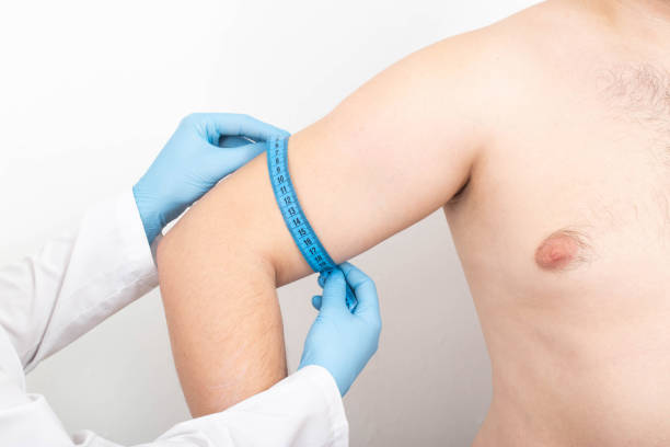 istock Doctor measures a man's triceps with a measuring tape for triceps augmentation with cosmetic surgery 1352463025
