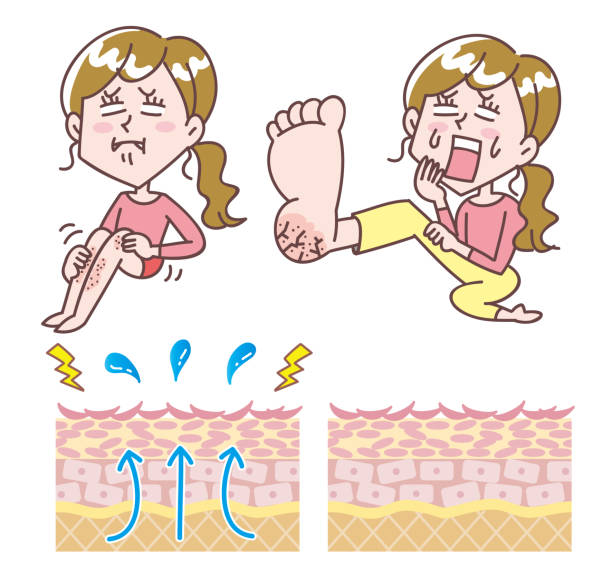 고민하는 여성과 피부 단면 세트 - sole of foot human foot women humor stock illustrations