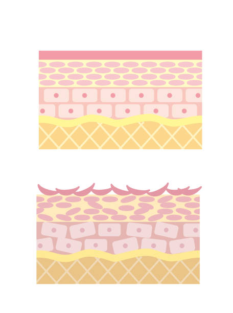 2 types of skin cross sections rough skin cross section and moist skin cross section dry skin stock illustrations