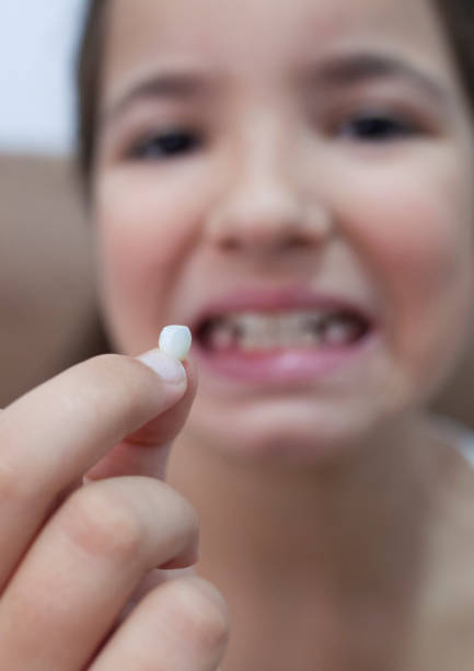 istock 9 years old girl showing her first canine tooth fallen out 1352620734