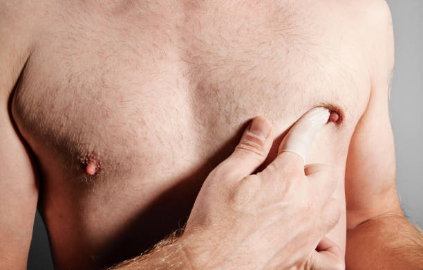 남자 압착 가슴 와 손가락 - breast chest the human body human skin 뉴스 사진 이미지