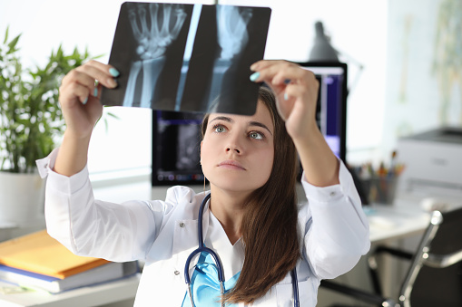 Woman doctor looking at xray of hand in clinic office. Diagnosis and treatment of arthritis concept