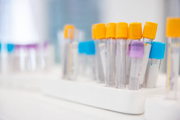 Sample tubes on a rack Blood sample test tubes on a rack, yellow and turquoise caps, medical equipment medicine bottle cap stock pictures, royalty-free photos & images