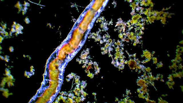 Oligochaete microscopic worm crawling