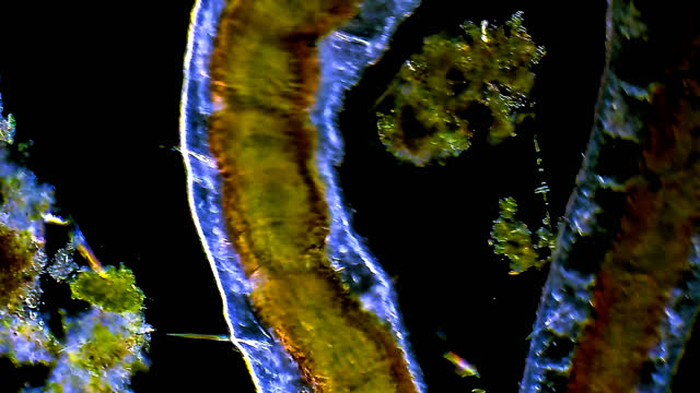 Oligochaete microscopic worm crawling