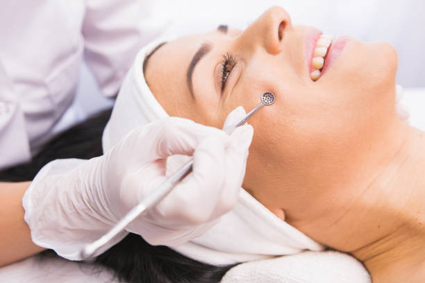 istock Cosmetician in protective gloves performs a cosmetic procedure on the patient's face using medical instrument tool for removal acne, comedones, impurities from the face. 1352913758