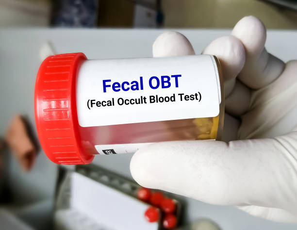 Fecal occult blood test (FOBT). Doctor holding sample container with feces or stool for occult blood test (OBT). stock photo
