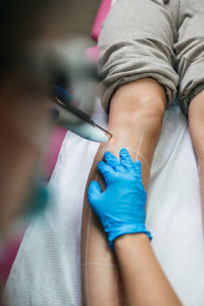 istock Laser hair removal procedure 1353084054