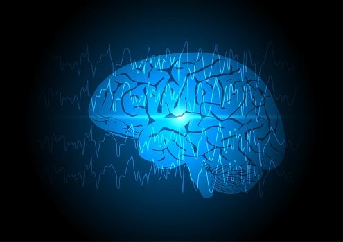 Focal seizure. Abnormal brain waves or EEG arising from one region of brain on blue technology background.