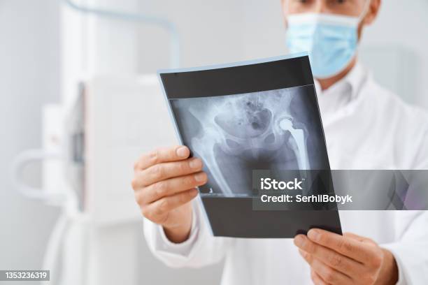 Doctor Looking Of Scan With Result After Ultrasound Of Pelvis Stock Photo - Download Image Now