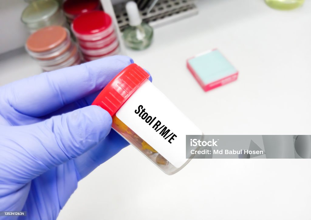 Stool Rme Stool Sample In Plastic Container For Routine Microscopic Examination ...