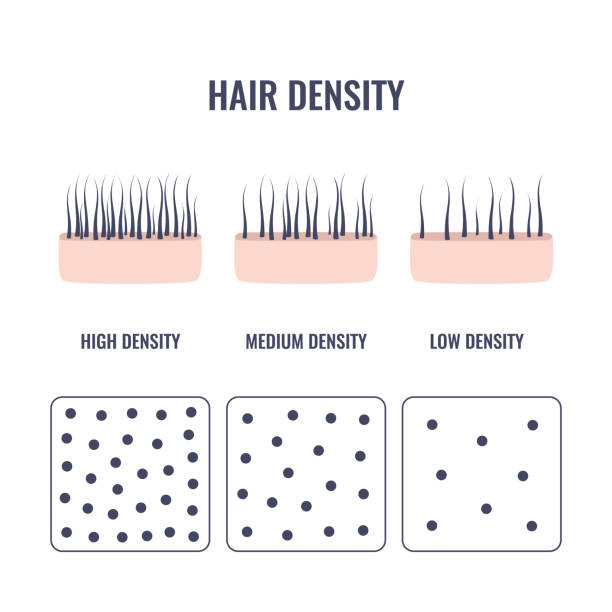 ilustrações de stock, clip art, desenhos animados e ícones de hair density types chart of low, medium, high strand volume - grosso