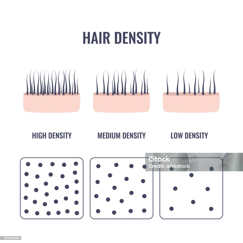 Hair Density Types Chart Of Low Medium High Strand Volume Stock  Illustration - Download Image Now - iStock