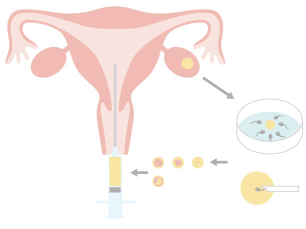 ilustraciones, imágenes clip art, dibujos animados e iconos de stock de tratamiento de la infertilidad mediante fecundación in vitro. - follicle stimulating hormone