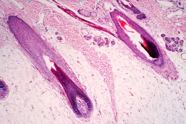 Photo of Histology of human scalp and hair follicle under the light microscope view. Human histology education. Haematoxylin and eosin staining technique slide.