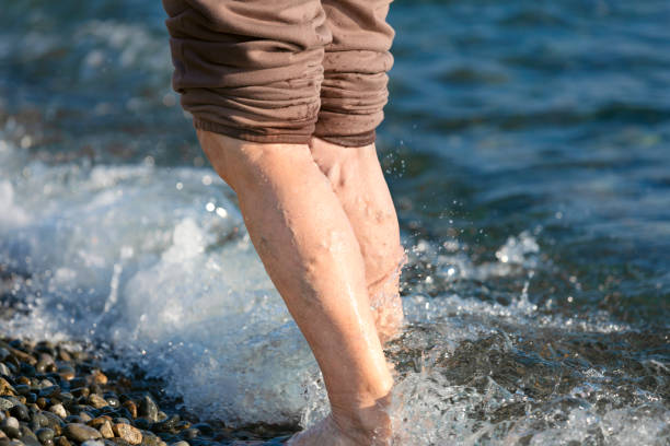 The legs of an elderly woman with altered varicose veins on the background of the sea in autumn. Lifestyle, tempering fall. The legs of an elderly woman with altered varicose veins on the background of the sea in autumn. Lifestyle, tempering fall. varicose vein stock pictures, royalty-free photos & images