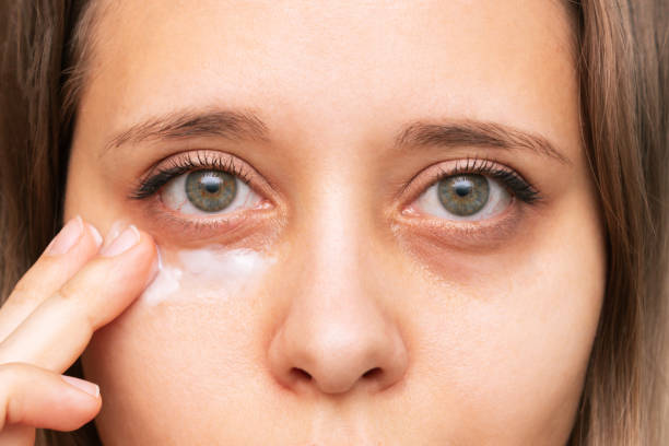 una mujer joven tocándose una piel de la cara mientras se aplica la crema para los ojos negros - cansado fotografías e imágenes de stock