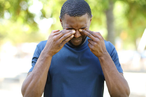 istock Man with black skin scratching itchy eyes in a park 1353826907