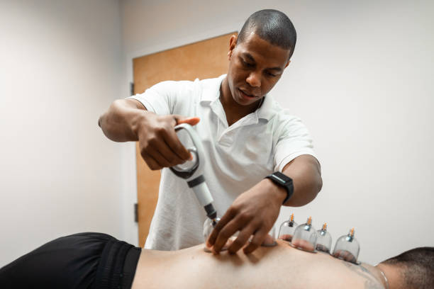 schröpftherapie - acupuncture cupping stock-fotos und bilder