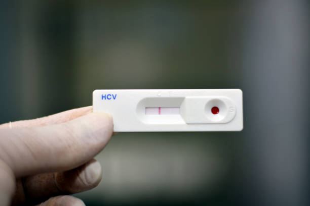 istock Negative results for Hepatitis C rapid test kits cassette that checks Hepatitis c Virus antibodies 1353875005
