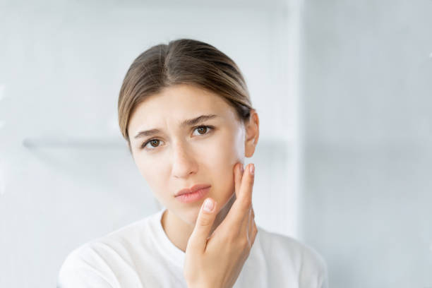 istock acne problem face inflammation woman touching skin 1353898848