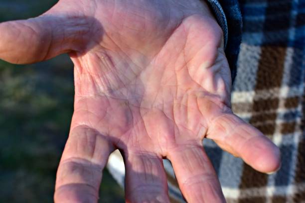 istock Hand palm of an elderly man 1354031624