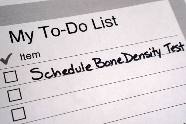 To Do List Reminder to Schedule Bone Density Test stock photo