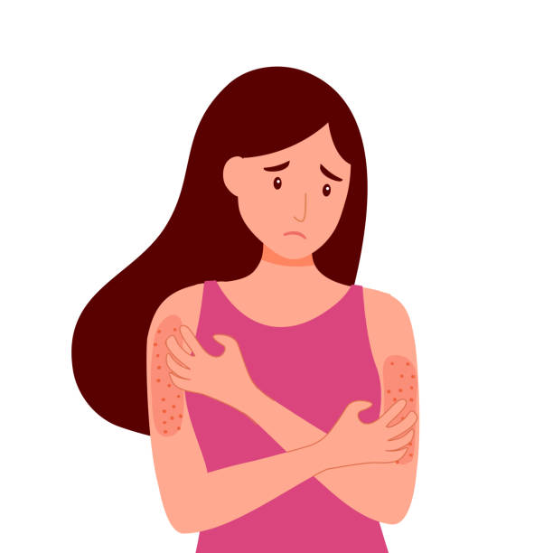 1,363 Itchy Skin Illustrations & Clip Art - iStock | Scratching, Eczema, Itchy 1,363 Itchy Skin Illustrations & Clip Art - iStock | Scratching, Eczema, Itchy
