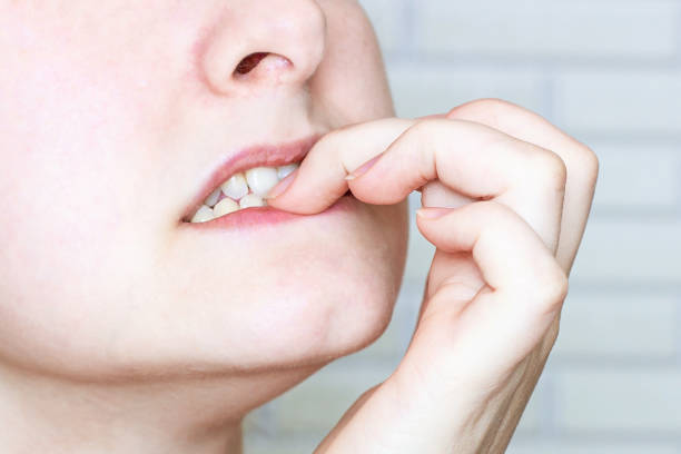 close-up of young caucasian woman biting fingernail - nail biting imagens e fotografias de stock