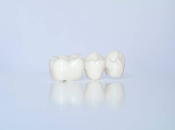Metal Free Ceramic Dental Crowns stock photo