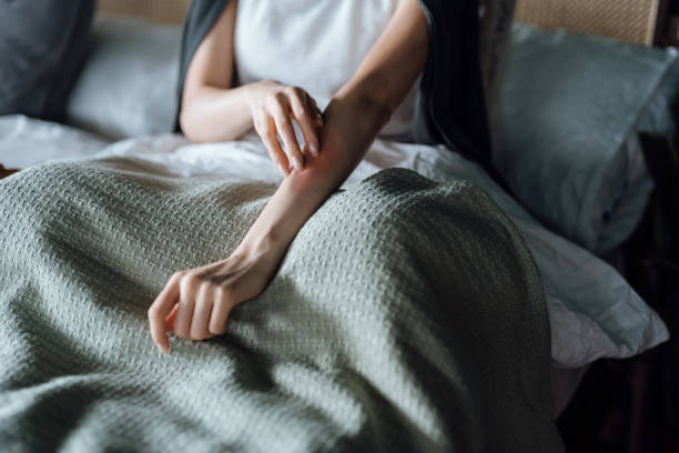colpo ritagliato di giovane donna che soffre di allergia cutanea, graffiandosi l'avambraccio con le dita - red bed foto e immagini stock
