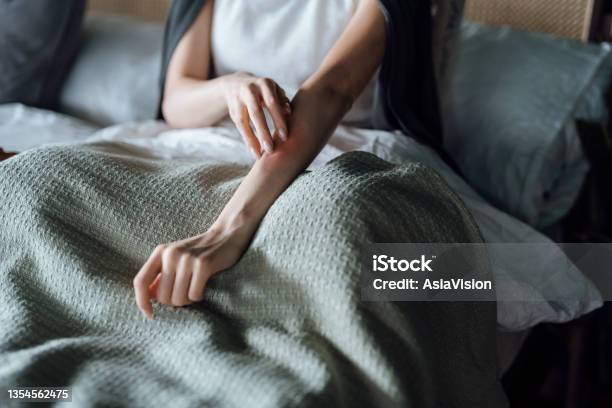 Cropped Shot Of Young Woman Suffering From Skin Allergy Scratching Her Forearm With Fingers Stock Photo - Download Image Now