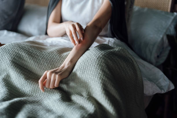 cropped shot of young woman suffering from skin allergy, scratching her forearm with fingers - coçar imagens e fotografias de stock