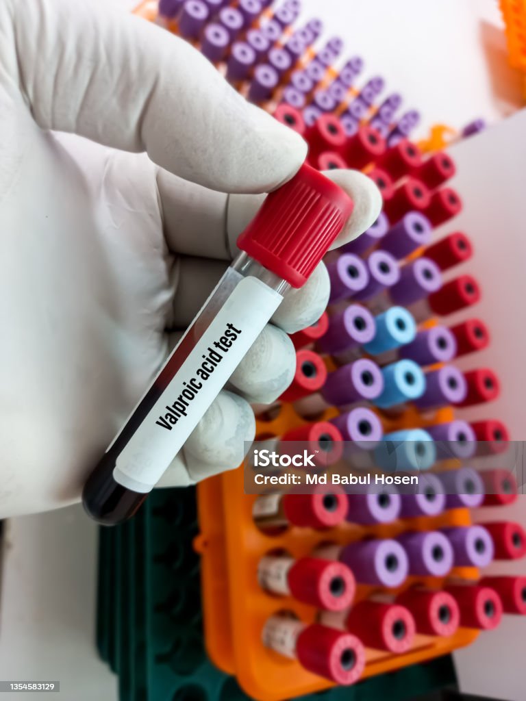 Blood Sample For Valproic Acid Test A Test For Maintain A Therapeutic Blood Sample For Valproic Acid Test A Test For Maintain A Therapeutic