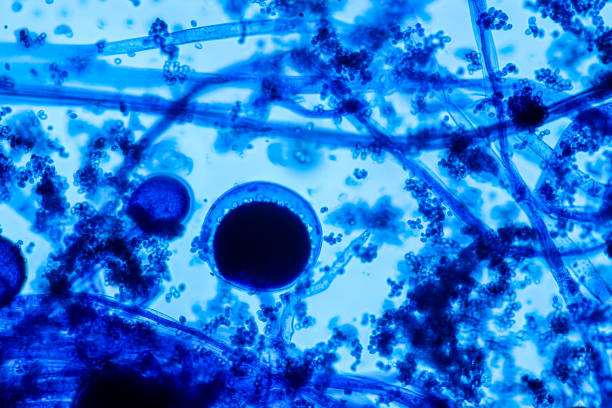 características do rhizopus é um gênero de fungos saprofáticos comuns em slide sob o microscópio para educação. - esporângio - fotografias e filmes do acervo