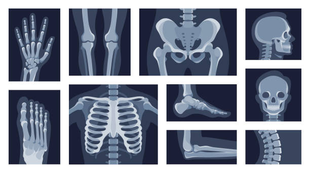 kolekcja różnych części ludzkiego ciała rentgen obrazy wektorowe płaska ilustracja. ustaw zdjęcie rentgenowskie - human bone illustrations stock illustrations