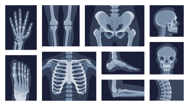 Collection different human body parts roentgen pictures vector flat illustration. Set x rays shot Collection different human body parts roentgen pictures vector flat illustration. Set x rays shot of head, hands, legs, torso, chest, hip, elbow, knee, spine skeleton character isolated on white x ray image stock illustrations