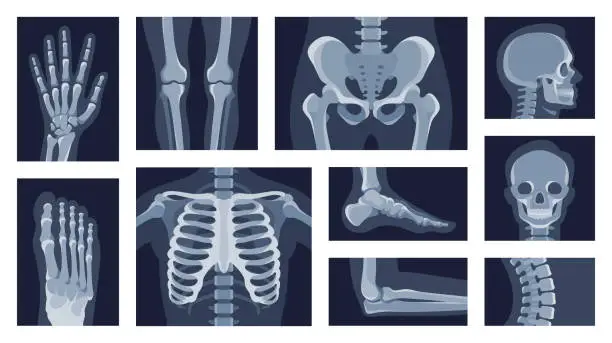 Vector illustration of Collection different human body parts roentgen pictures vector flat illustration. Set x rays shot
