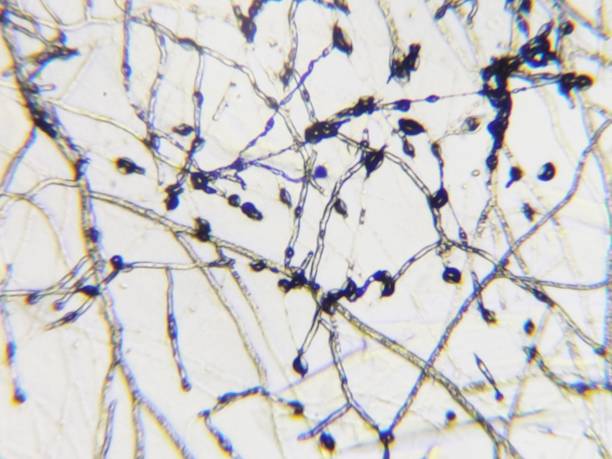 istock Trichiphyton genus dermatophyte 1354716660