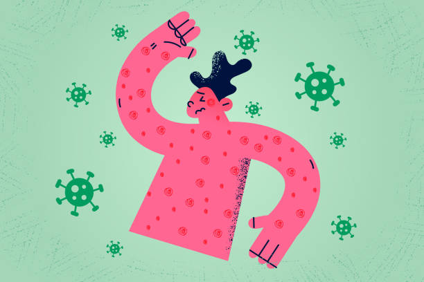 Unhealthy man covered in sports suffer from measles Sick guy covered in red spots on body struggle with measles or rash virus. Unhealthy man suffer from rubella or dermatitis. Healthcare and medicine. Infectious disease. Flat vector illustration. measles stock illustrations