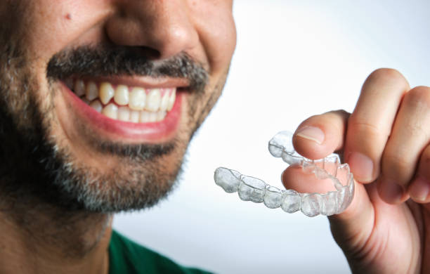 istock unrecognizable dark-haired man with beard putting on transparent dental retainer 1354983230