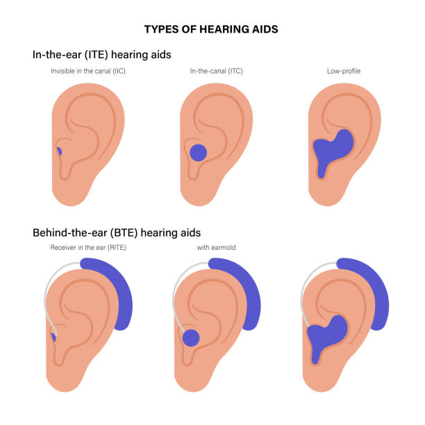 типы слуховых аппаратов - hearing aid isolated technology healthcare and medicine stock illustrations