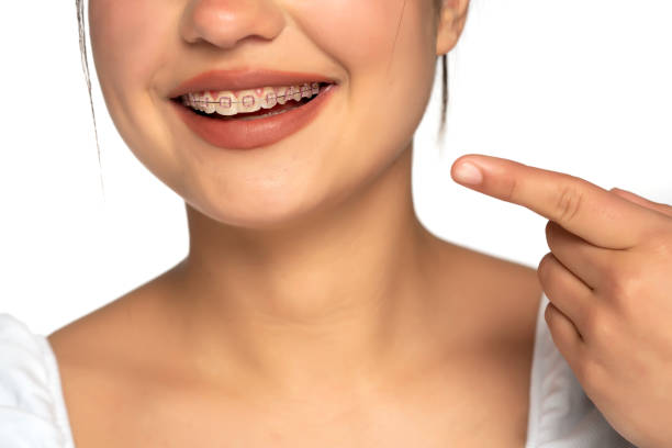 istock a young woman points a finger at her dentures 1355075111